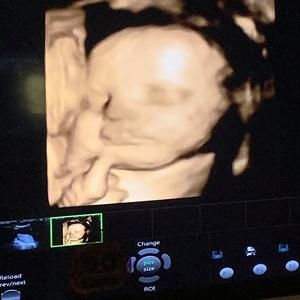 Meet your Posher, Dennis